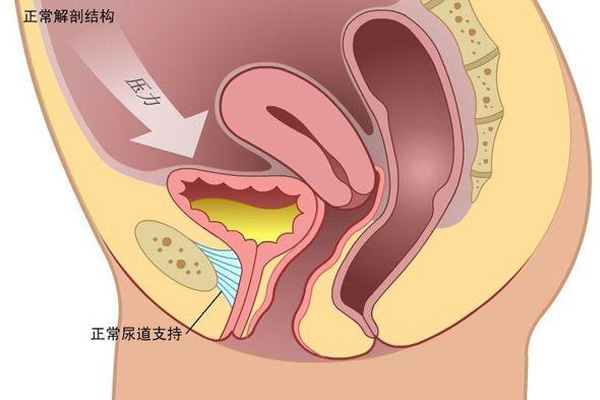 女性尿道炎高发期是什么时期(图1)